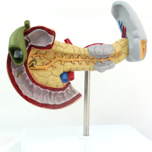 VISCERA05 (12542) Anatomisches pathologisches Modell von Pankreas, Zwölffingerdarm und Milz